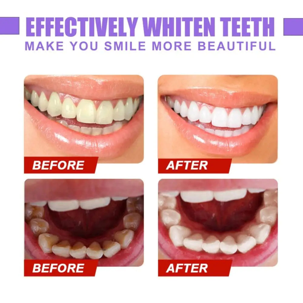 Teeth Enamel Care