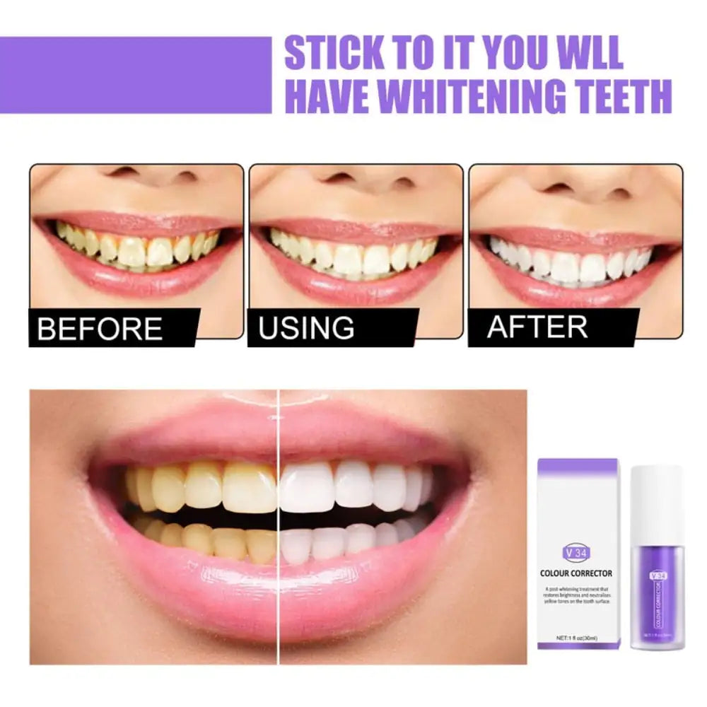 Teeth Whitening Teeth V34 Colour Corrector